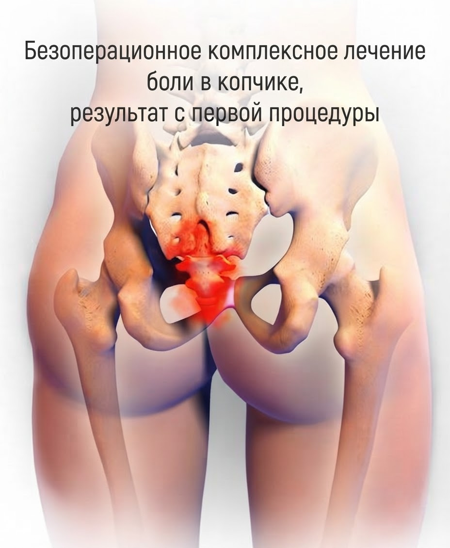 После родов больно сидеть? Вернем комфорт без подушки-бублика | Алматы | 38000 тг за первый прием